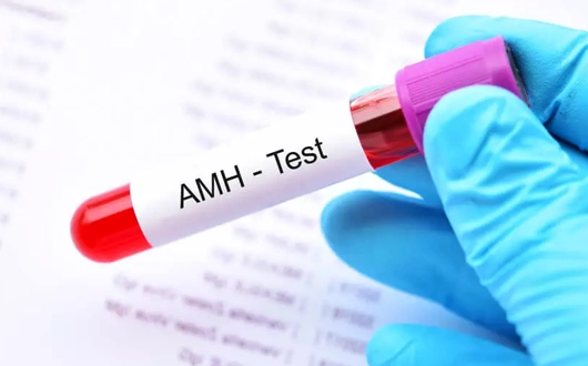 AMH Testi