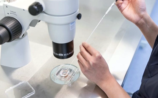 IVF Embryo Transfer in Turkey