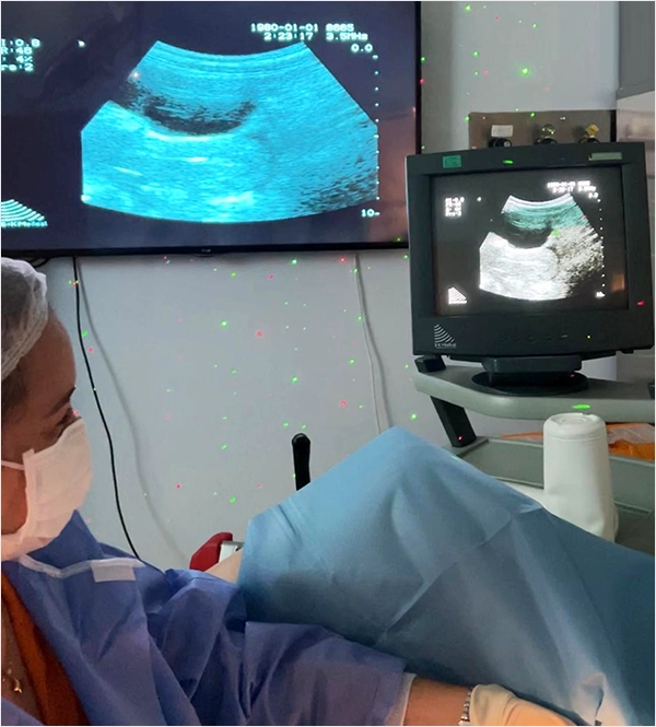 IVF Embryo Transfer in Turkey