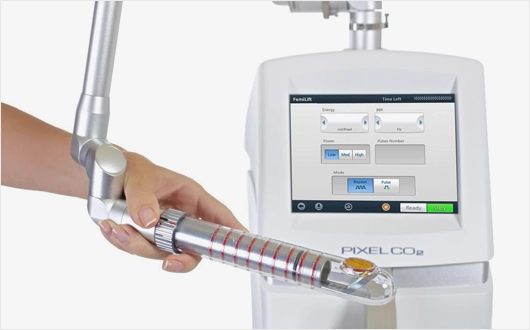 Laser Treatment for Urinary Incontinence